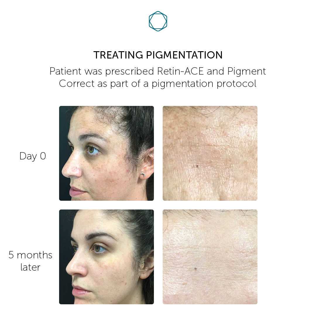 Cellderma Pigment Correct 30ml