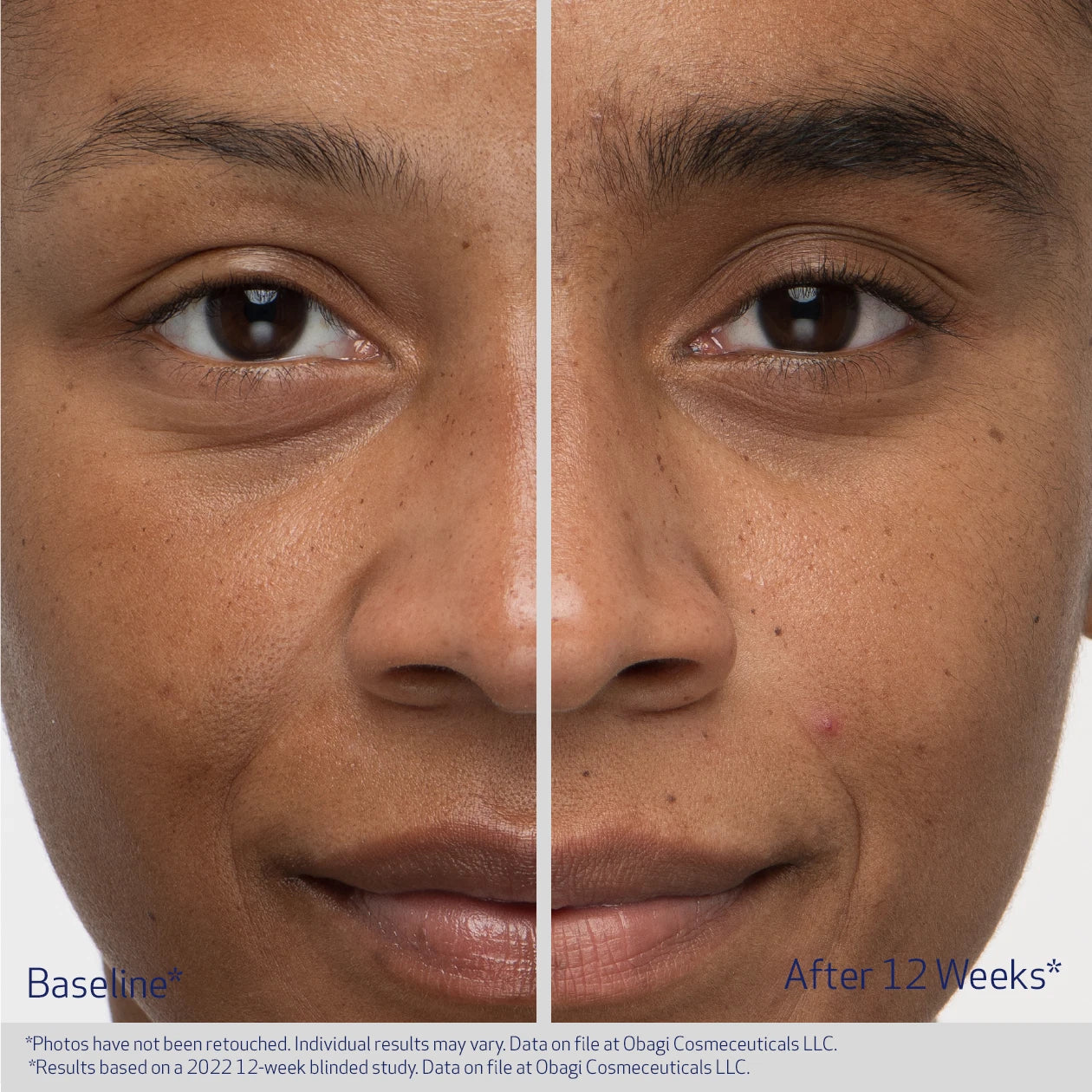 Obagi Nu-Cil Eyebrow Boosting Serum 5ml