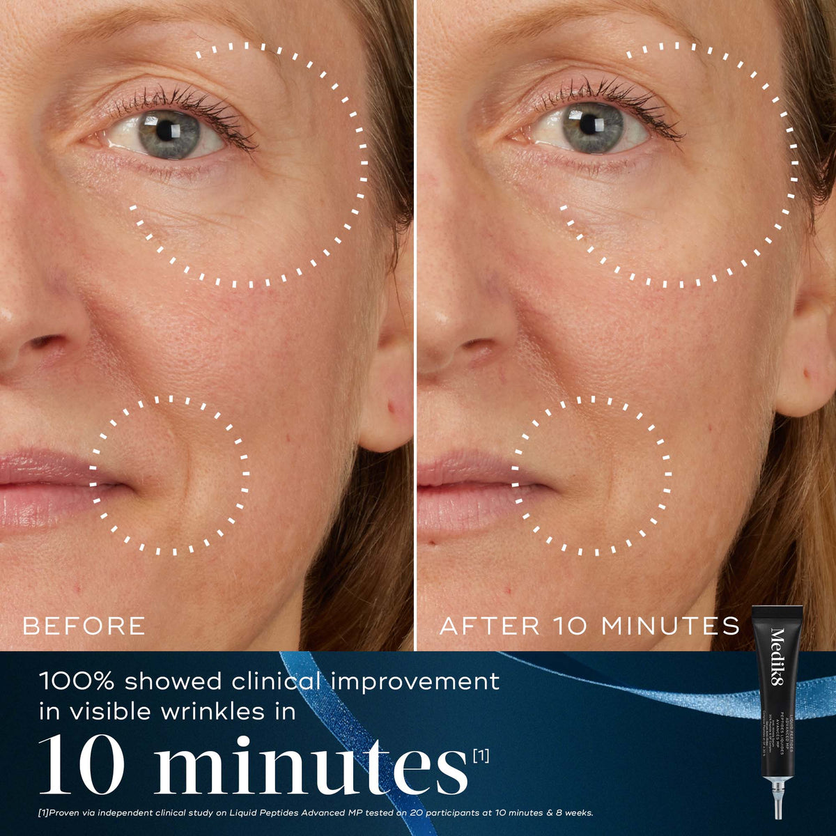 Medik8 Age-Defying Essentials Kit