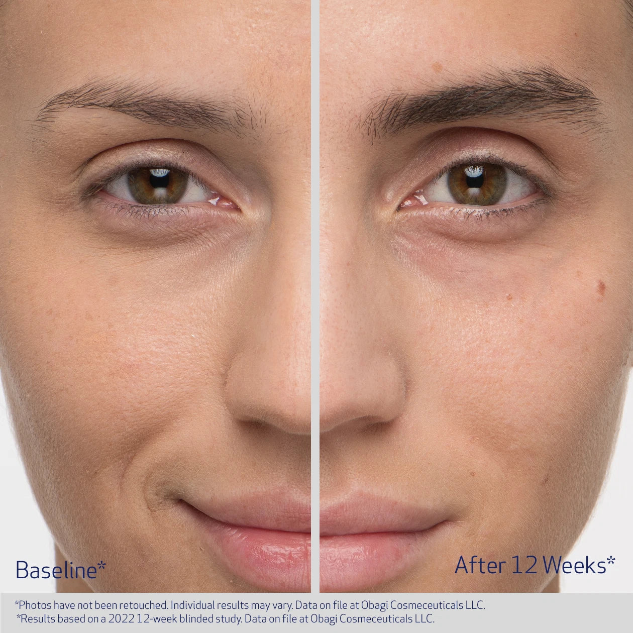 Obagi Nu-Cil Eyebrow Boosting Serum 5ml