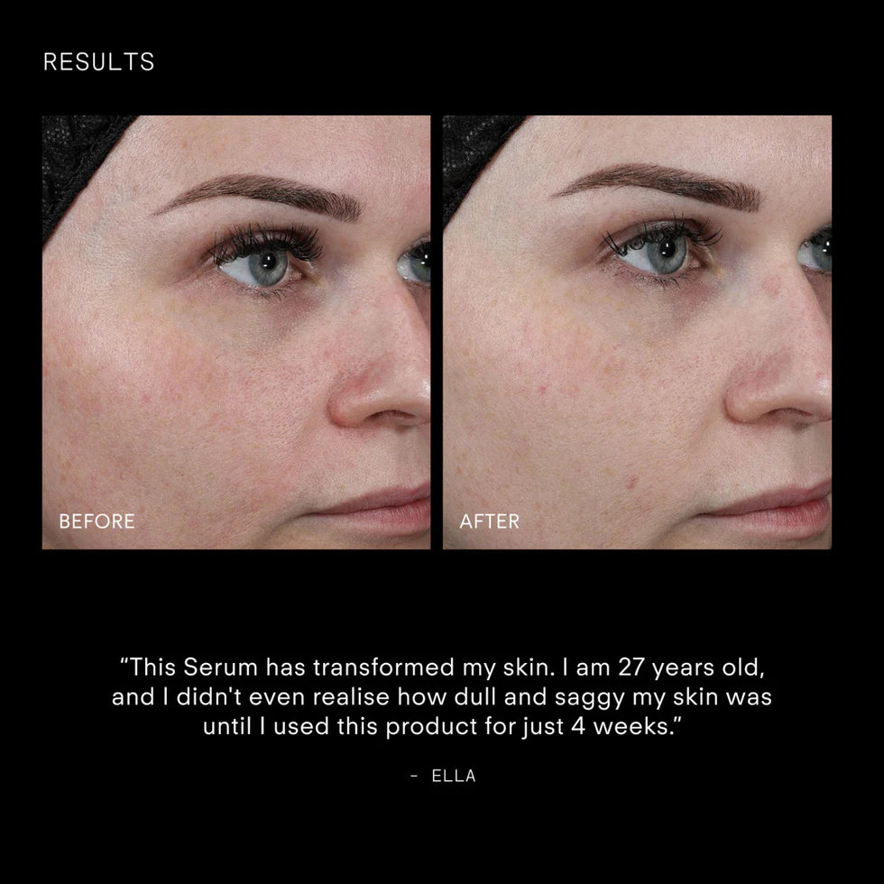 Ultraceuticals Youth Boost ExoSignal GF² Facial Serum
