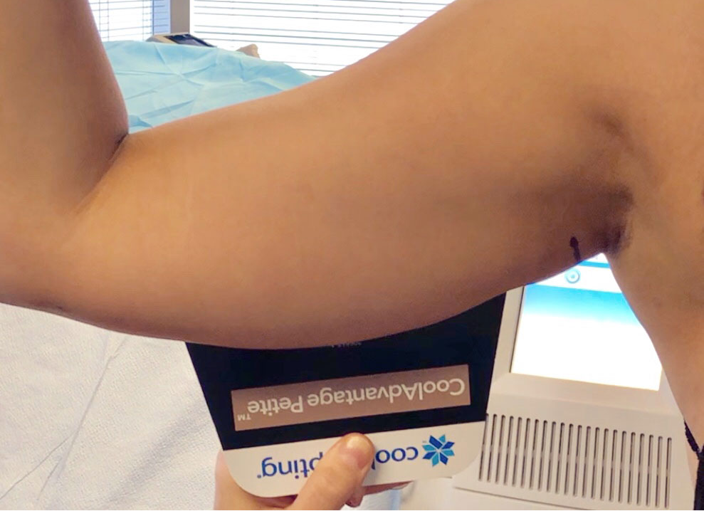 Arm Transformation Package (save €1,101)