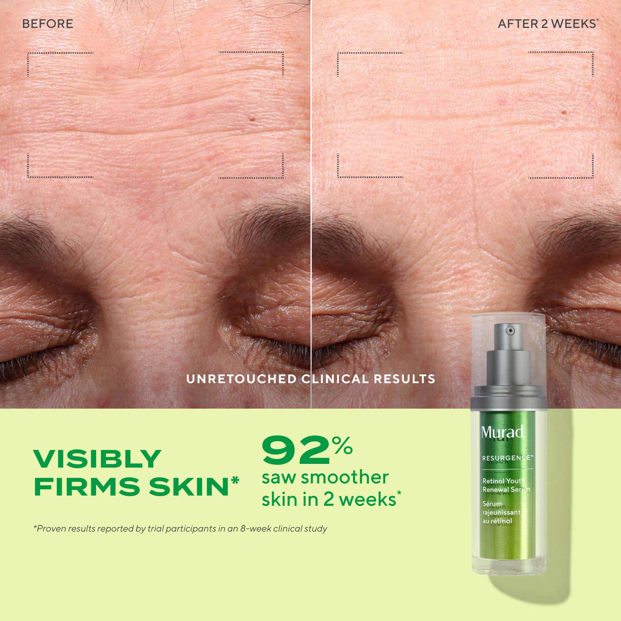 Murad Retinol Youth Renewal Serum 30ml