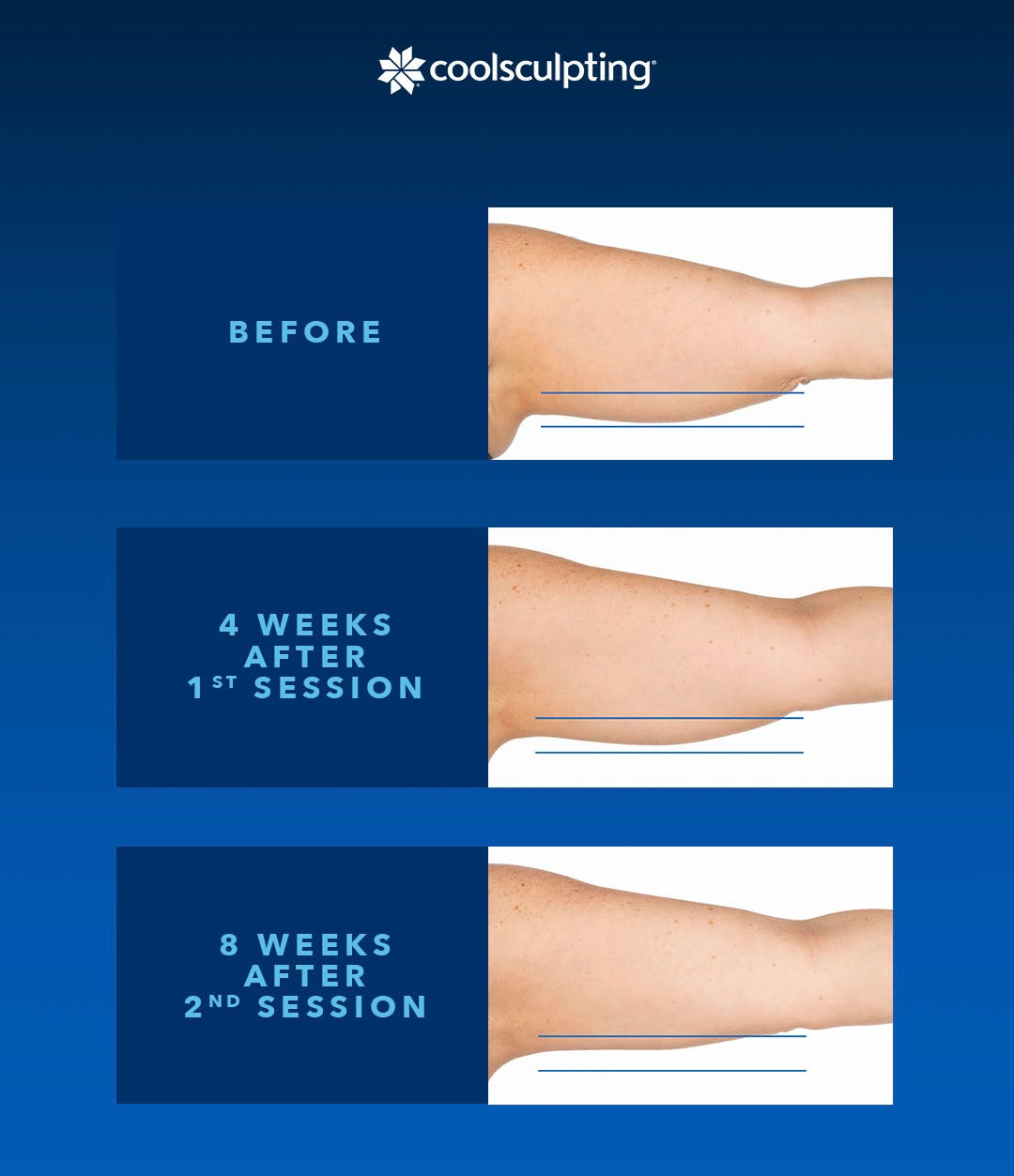 Arm Transformation Package (save €1,101)