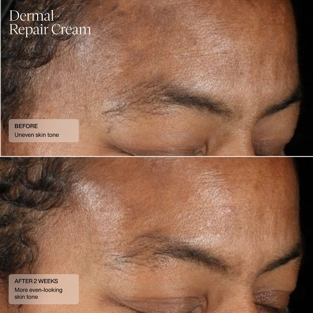 Sente Dermal Repair Cream