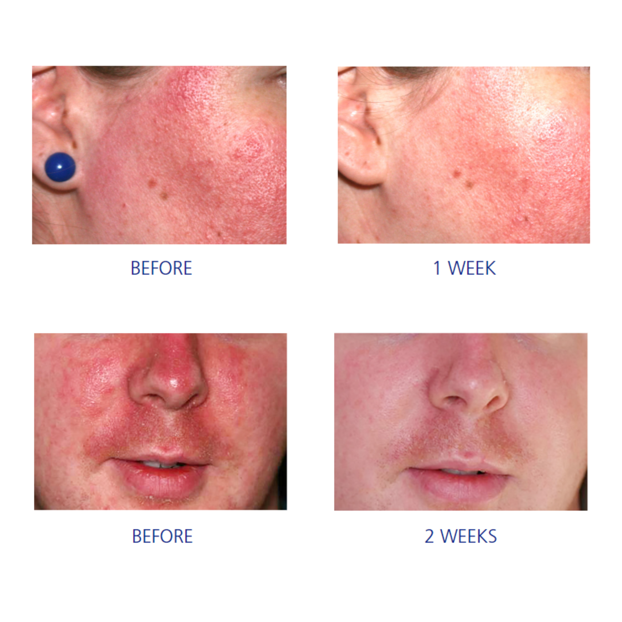 iS Clinical Pro-Heal Serum Advance+