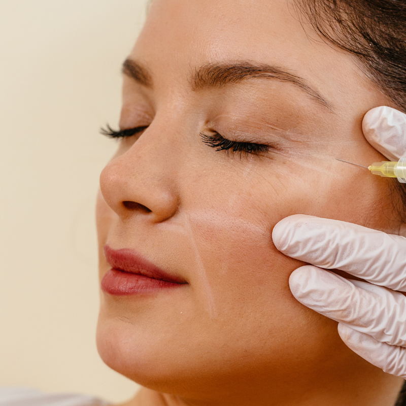 Summer Six Glass Skin Duo: Anti-Wrinkle Injections 2/3 Areas + Choice of Skin Booster