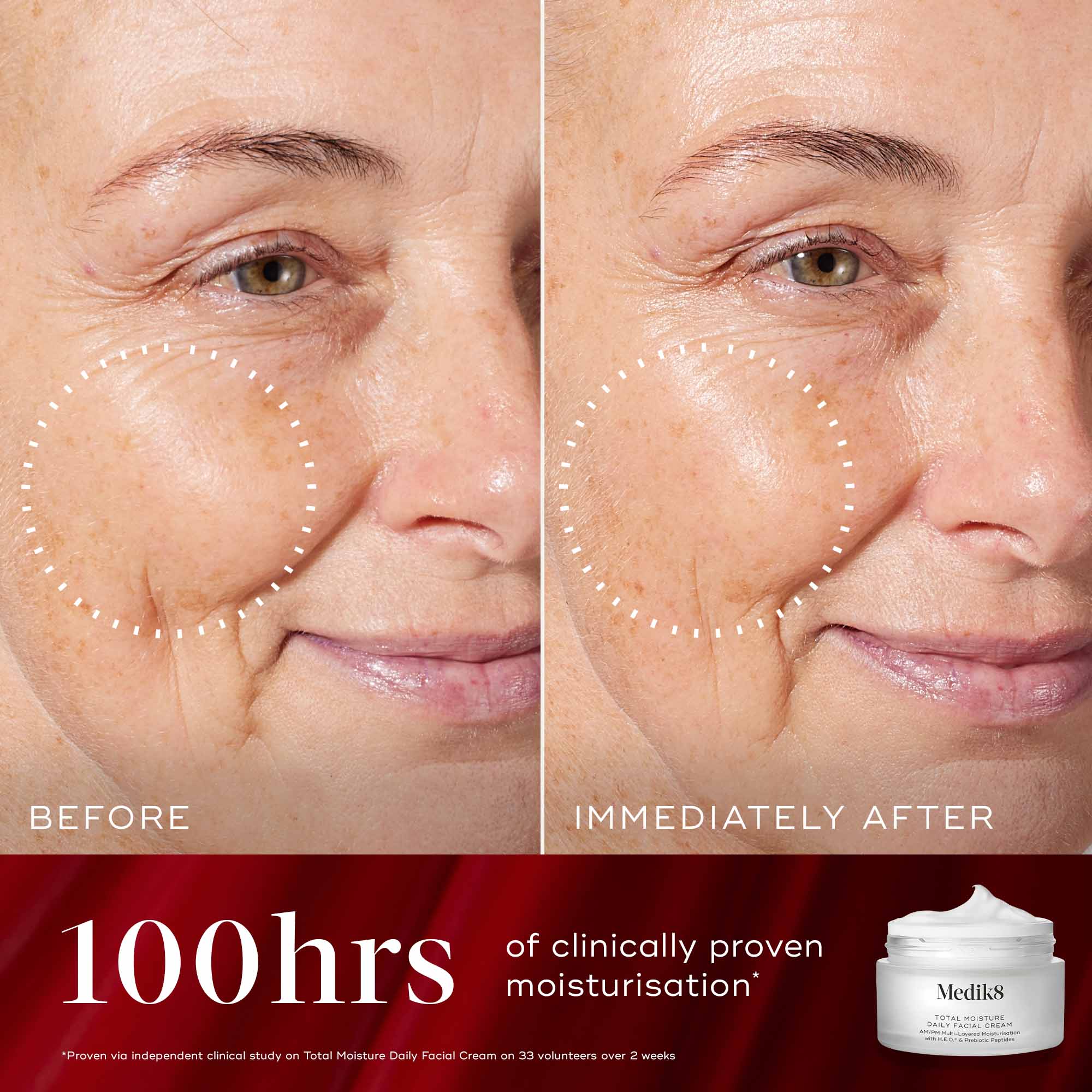 Medik8 Radiance Wrapped - Brightening & Barrier-Strengthening Duo