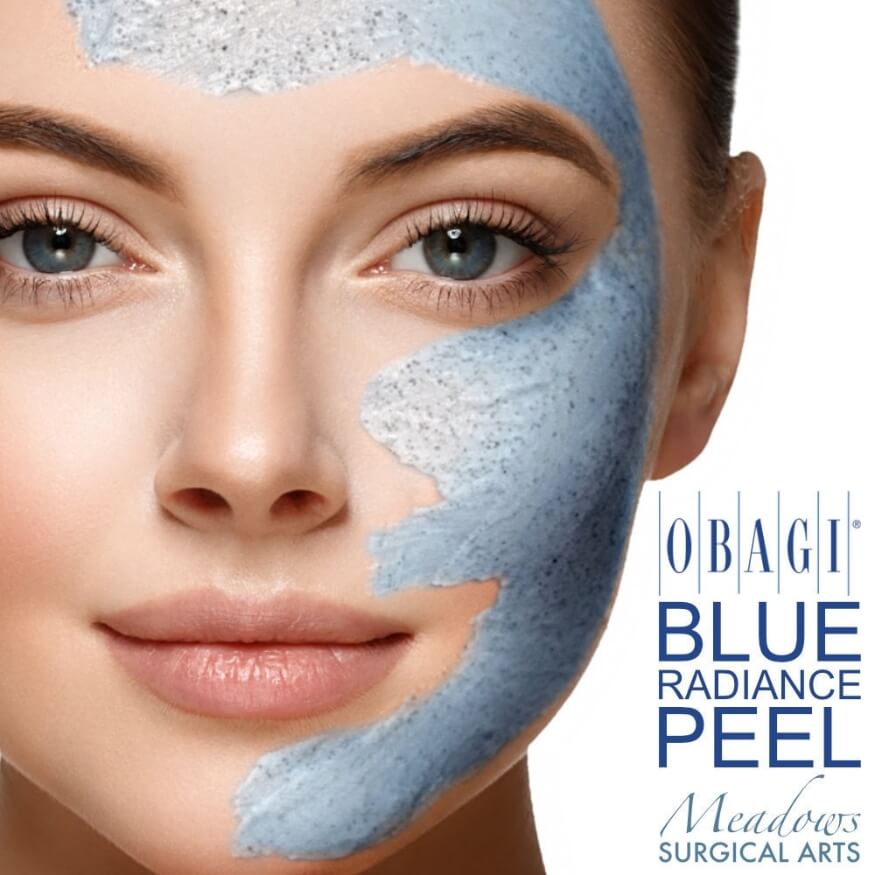 Any Bespoke 30-Min or 50-Min Peel Course of 4 (save up to €321)