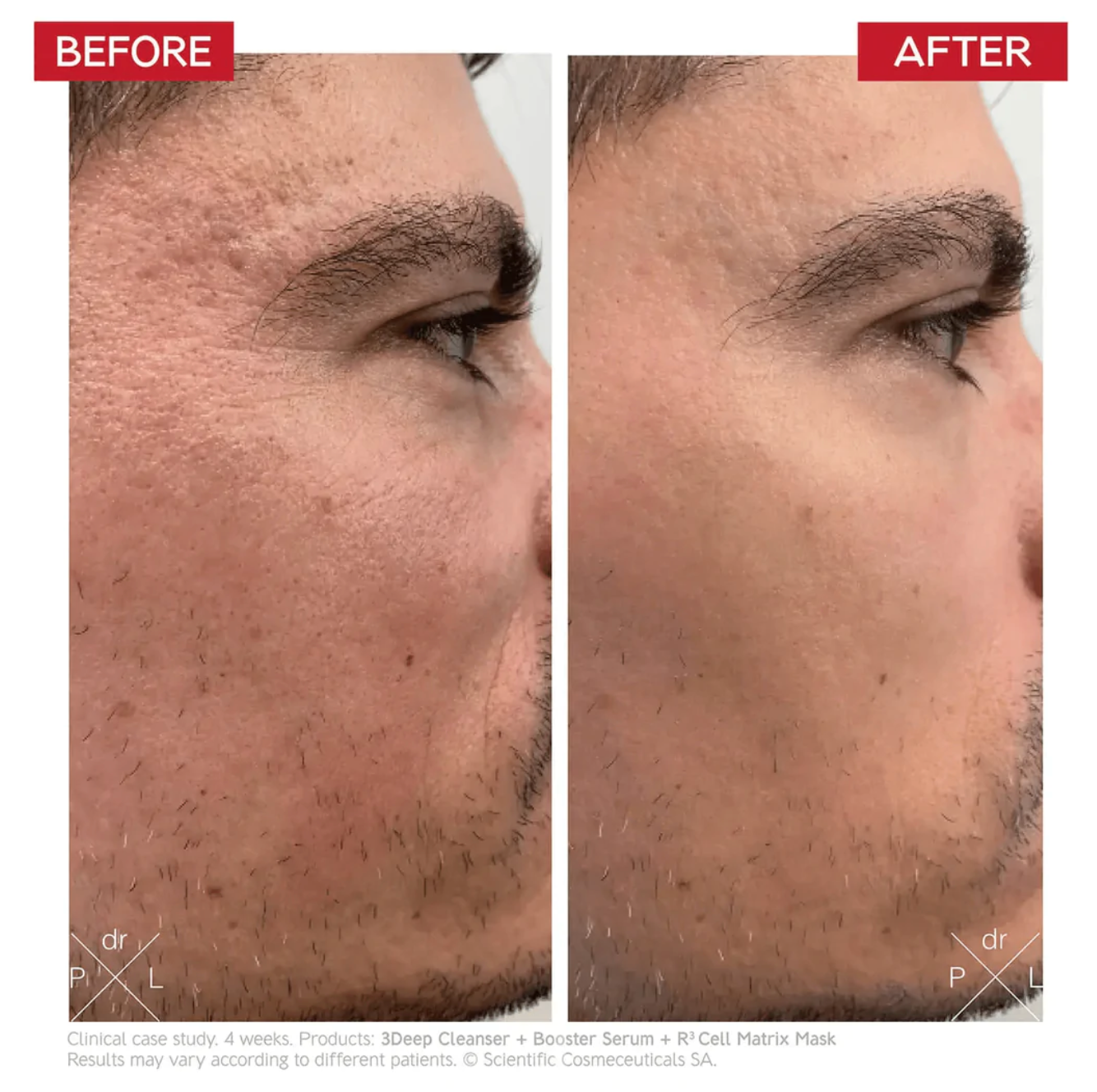 Dr. Levy Booster Serum 30ml