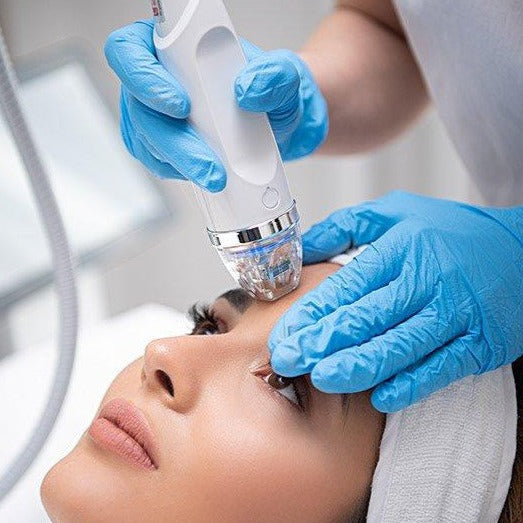 Utlimate Skin Rejuvenation: Secret RF Microneedling +CO2 Laser +Exosomes (save up to €1,201)