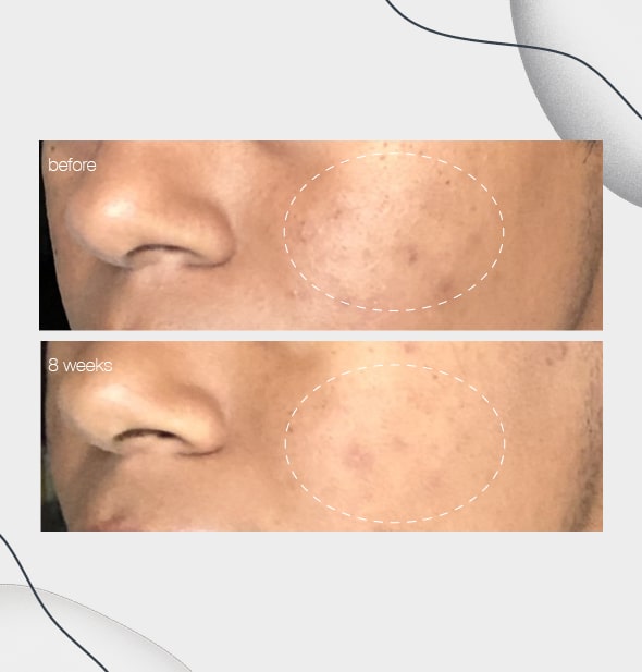 Dermalogica powerbright dark spot serum