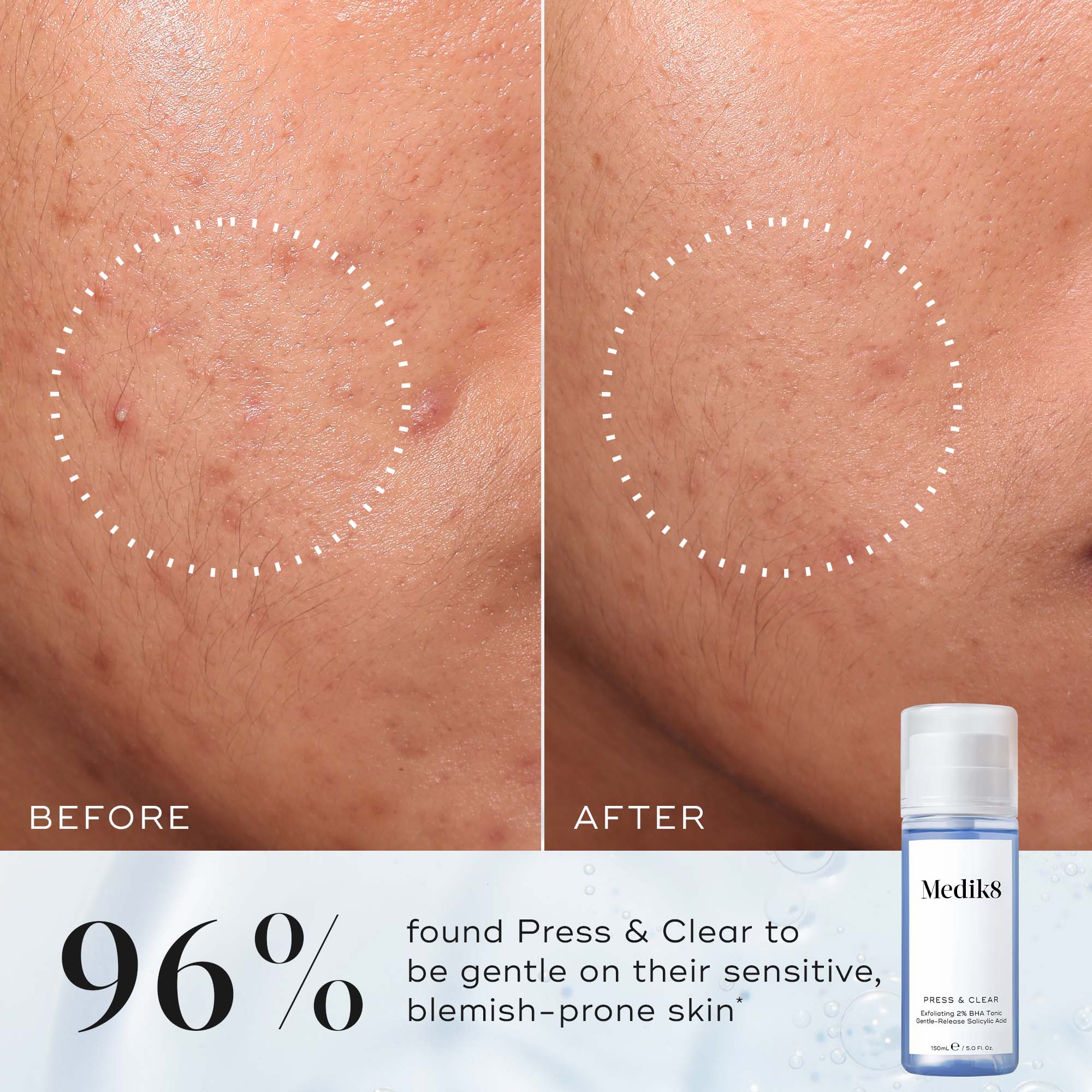 Medik8 Press and Clear Refill