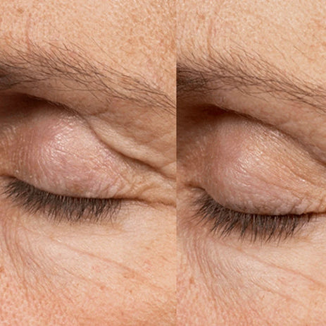 NCTF Eye Boosters (save €51)