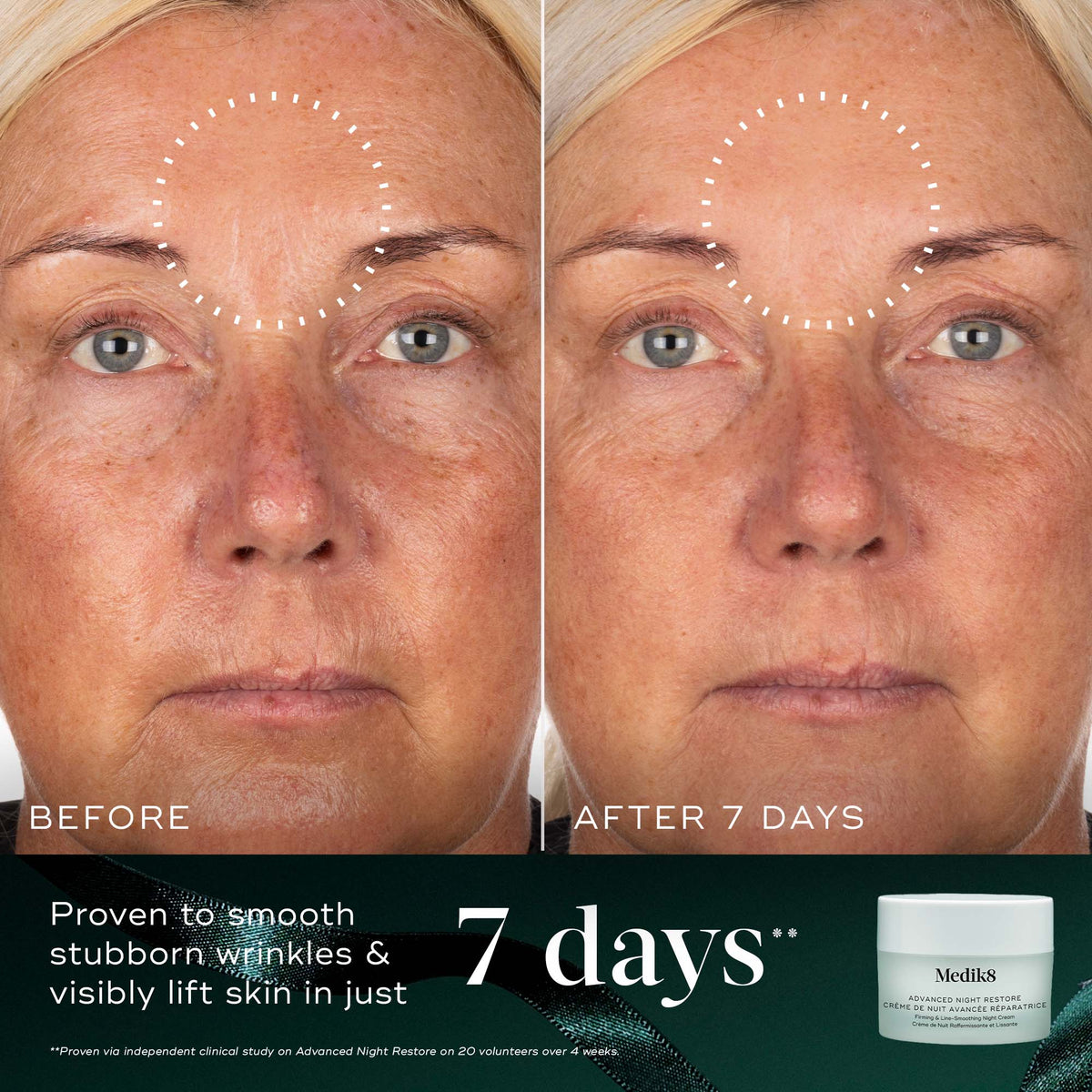 Medik8 Nighttime Nourish Kit