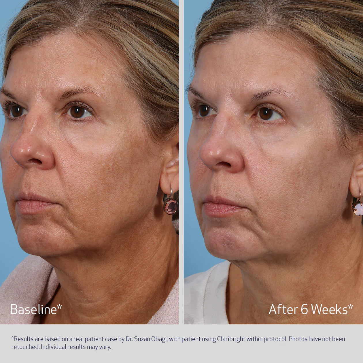 SuzanObagiMD Claribright Radiance Brightening Lotion 50ml