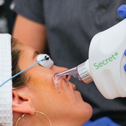 Black Friday Sale: CO2 Laser Glow Facial (save €301)