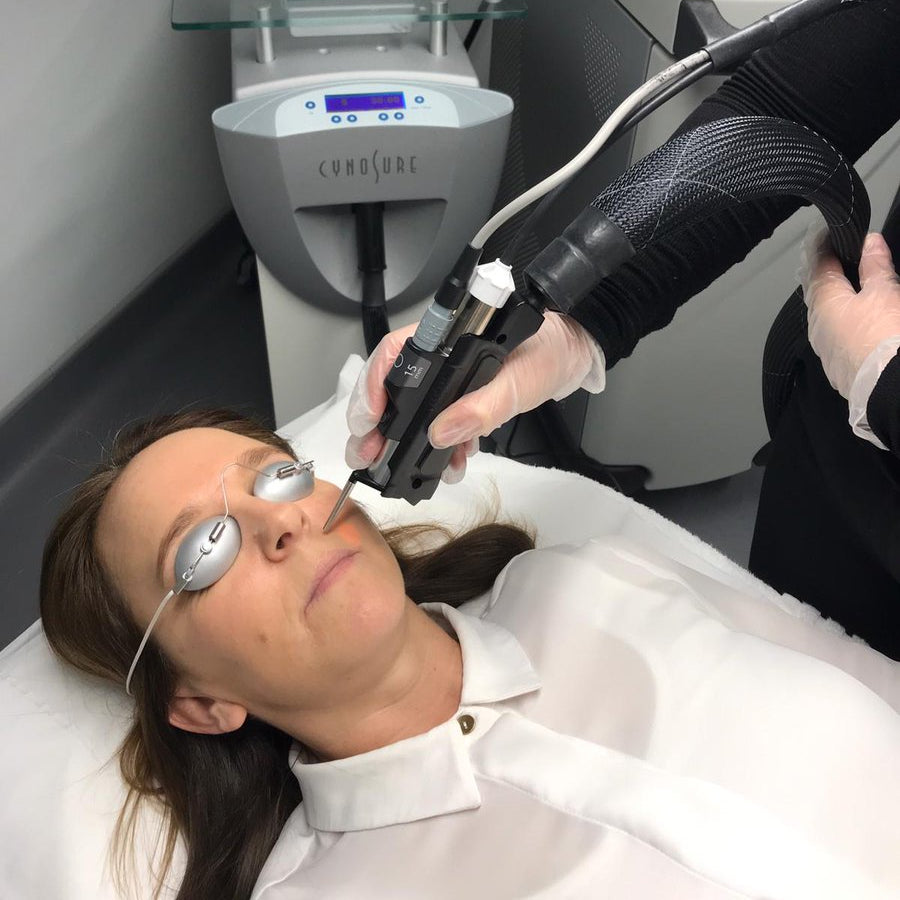 Laser thread vein reduction course of 4 (save up to €601)