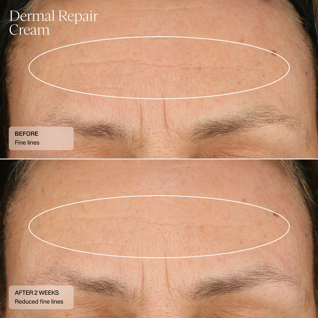 Sente Dermal Repair Cream