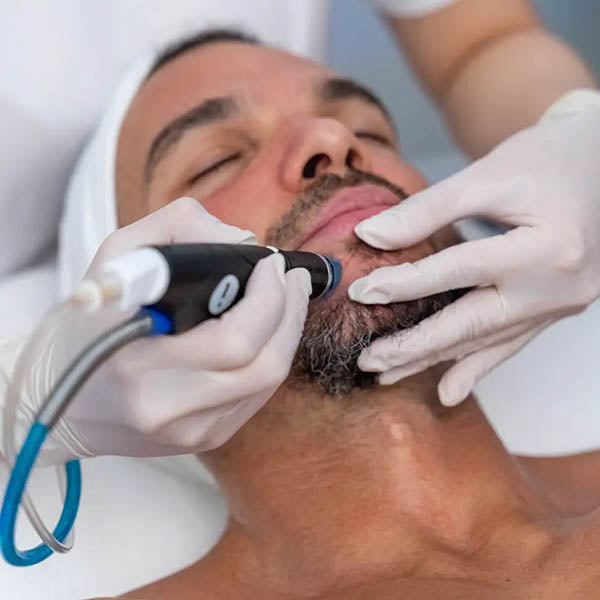 Flash Sale: HydraFacial from only €99 (save €101)