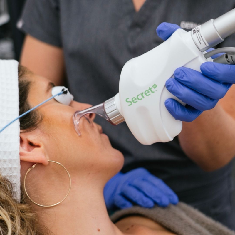 The Ultimate Lift & Resurface Collagen Duo: Ultherapy & CO2 Laser (save €1,751)