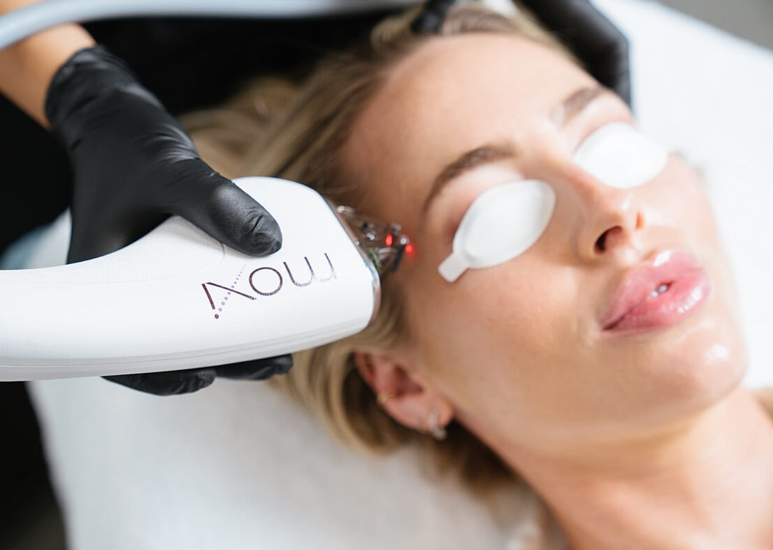 MOXI Laser Skin Rejuvenation Course of 3 (save 10%)