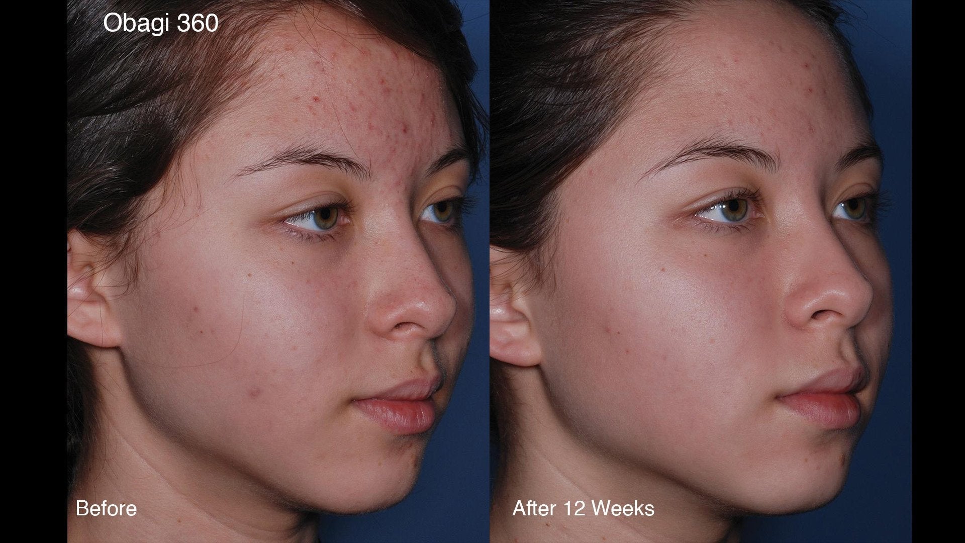 Obagi  CLENZIderm Daily Foaming Cleanser 118ml