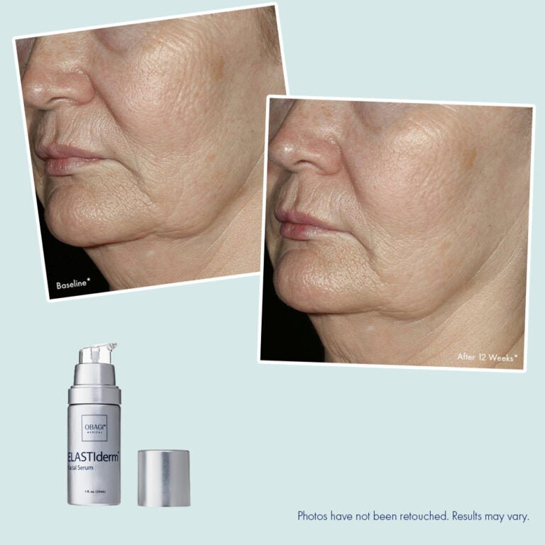 Obagi ELASTIderm Facial Serum 30ml