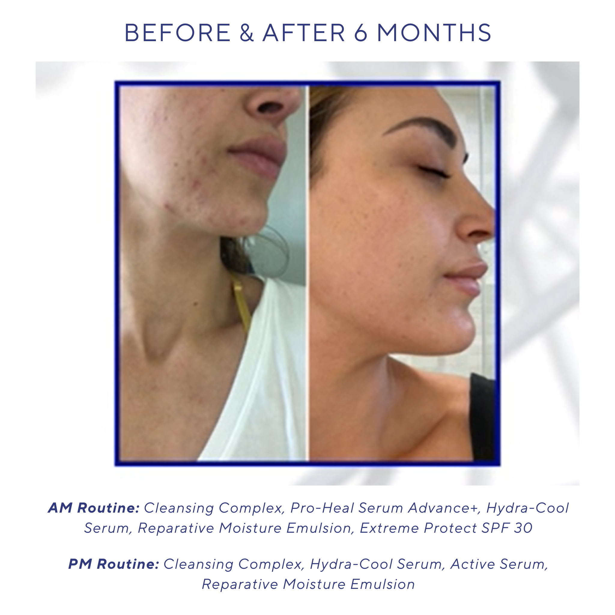 iS Clinical Cleansing Complex