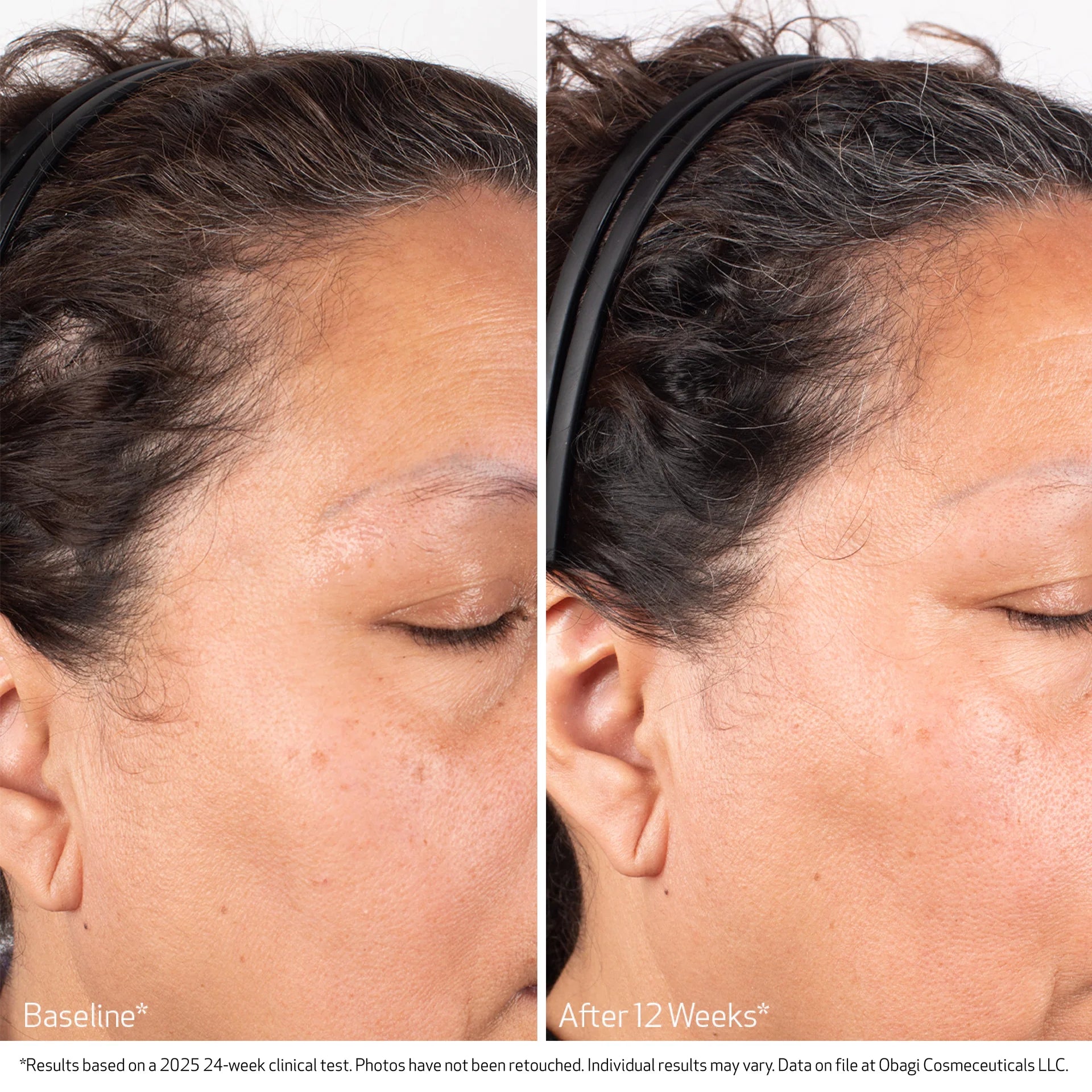 Obagi BIOSTIM™ SCALP SERUM