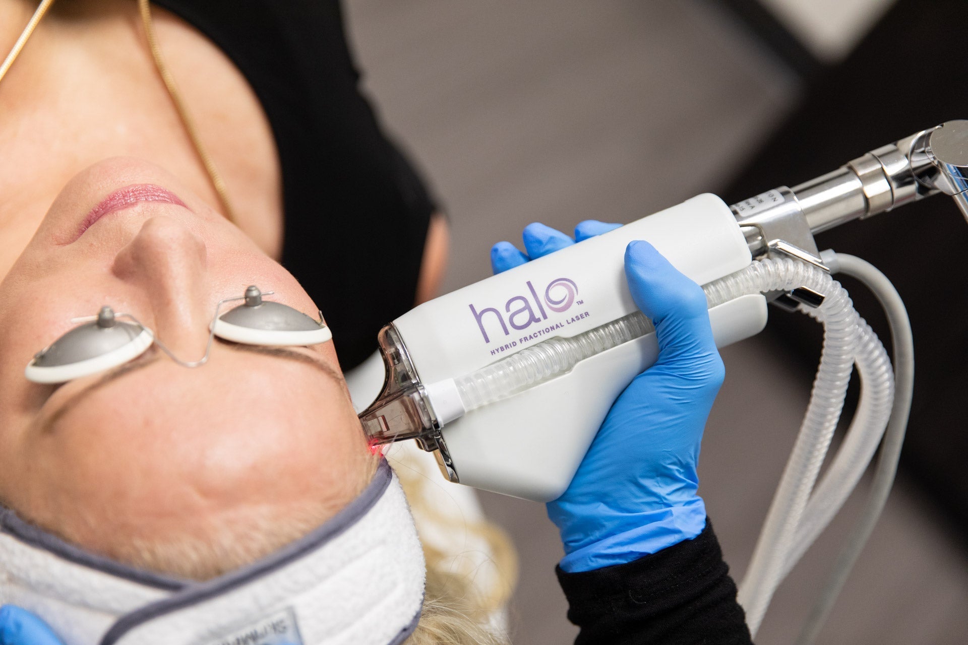 HALO Laser Skin Resurfacing Package for Face & Neck Course of two (save €1,000)