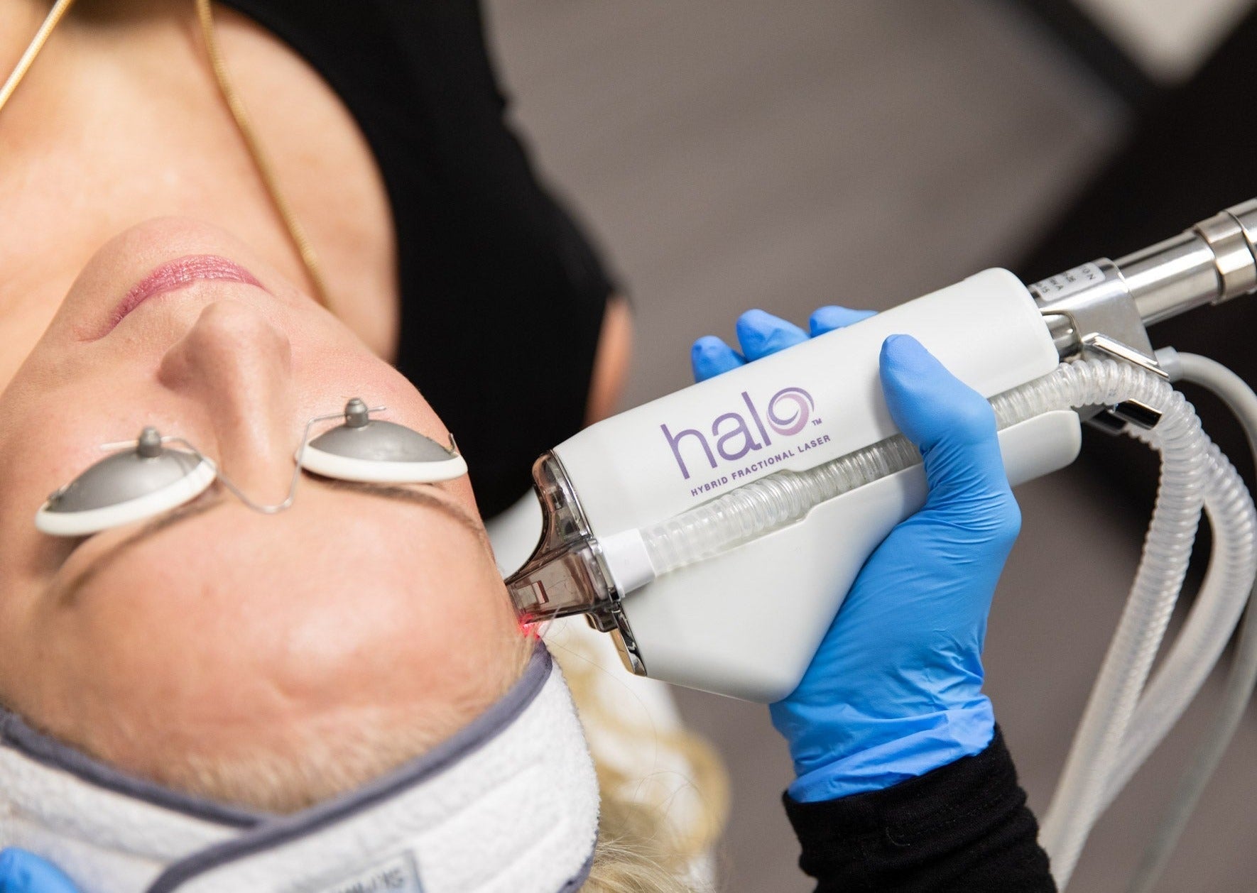 HALO Laser Skin Resurfacing save up to €1,401