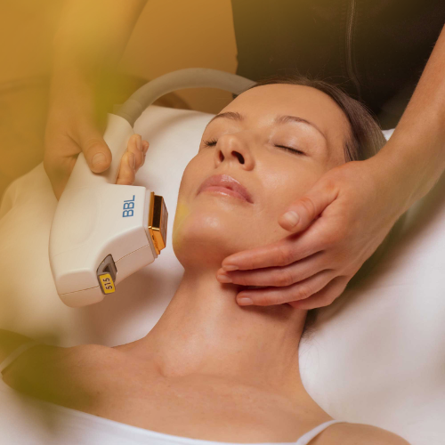 Summer Six Radiance Reset: BBL + Obagi Blue Peel (save up to €651)
