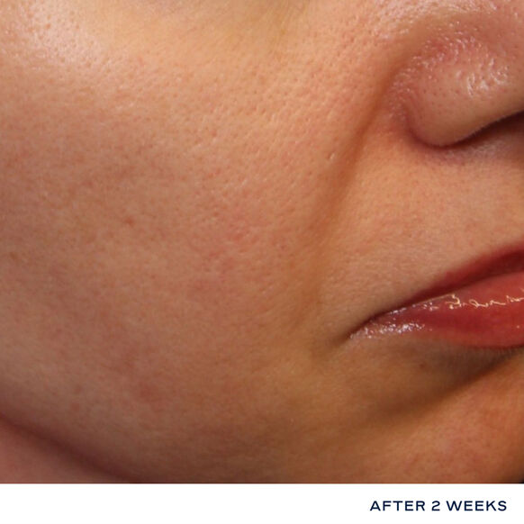 Daily Dynamic Hydrator