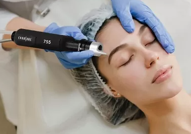 Consultation for Picosure Laser Skin Rejuvenation (Fee Redeemable)
