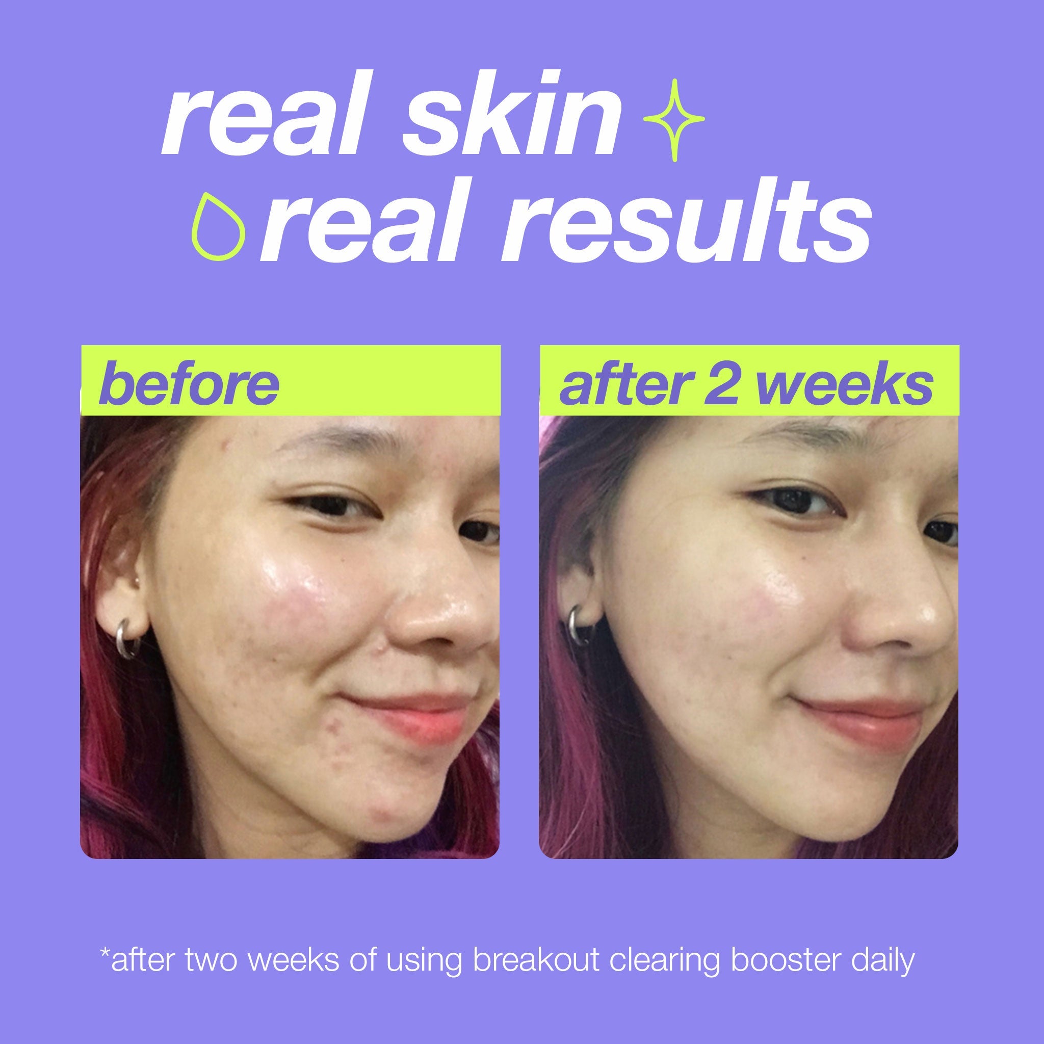 Dermalogica breakout clearing booster