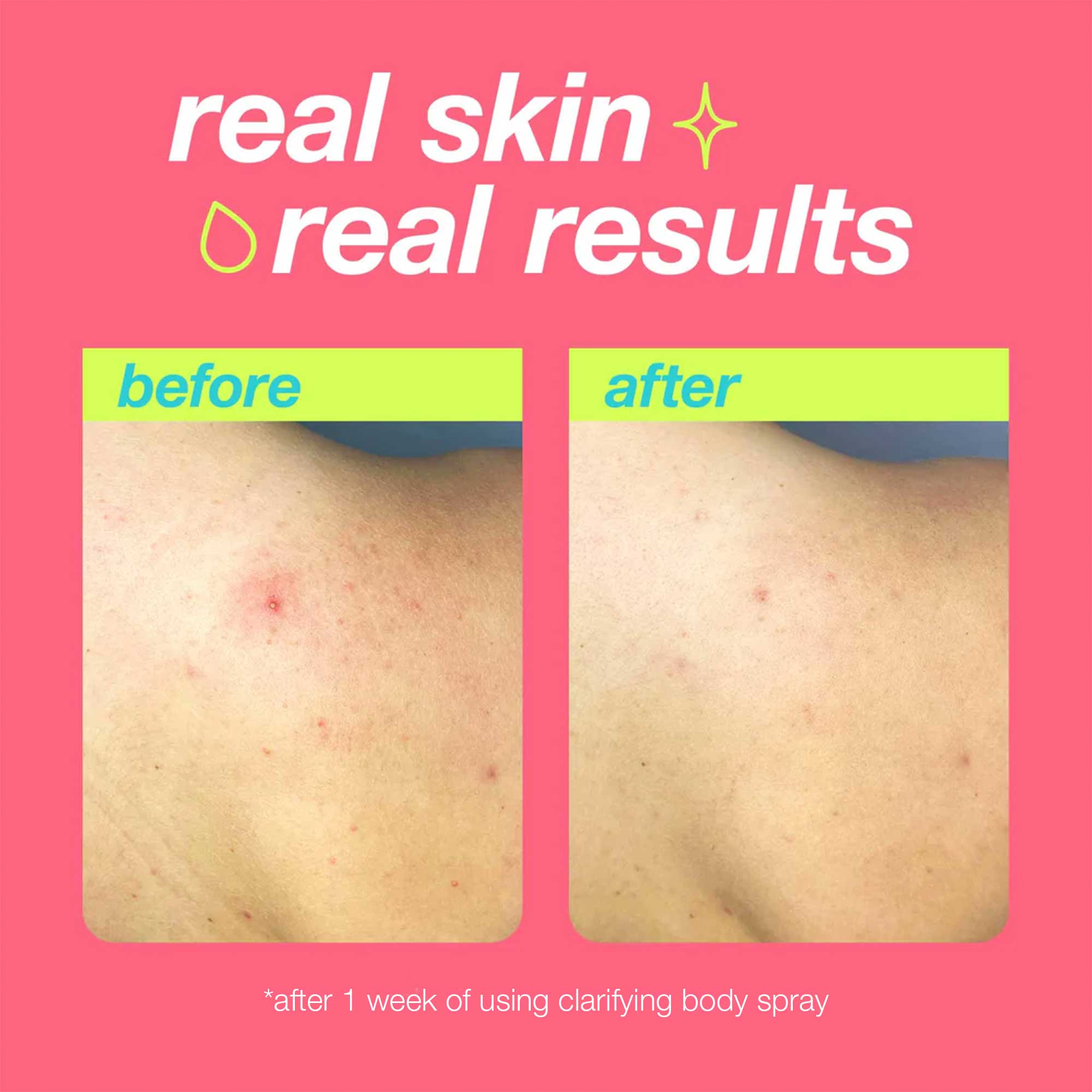 Dermalogica Clarifying Body Spray