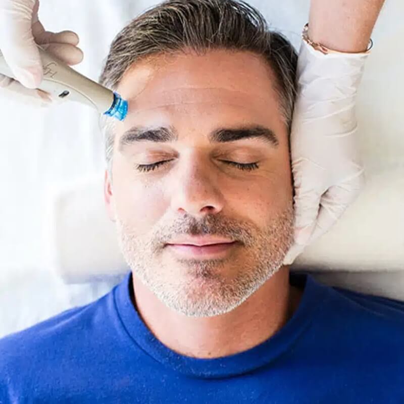 Flash Sale: HydraFacial from only €99 (save €101)