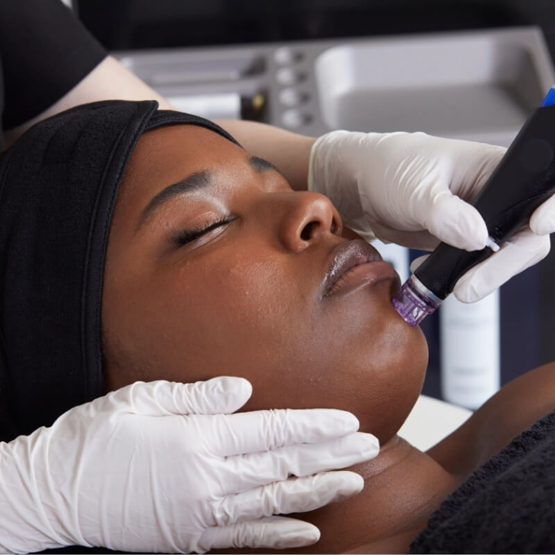 Summer Six City Radiance: Choice of Facial or Peel with LED (save up to €201)
