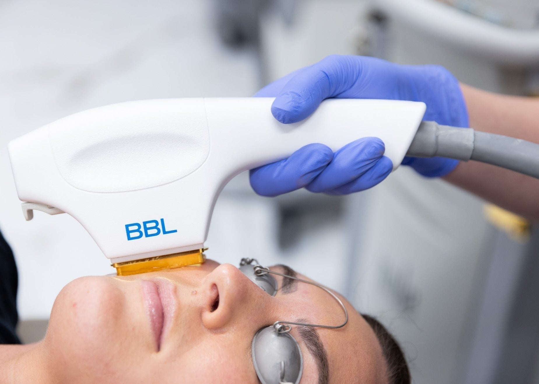 BBL HERO Photofacial Skin Rejuvenation save up to €701