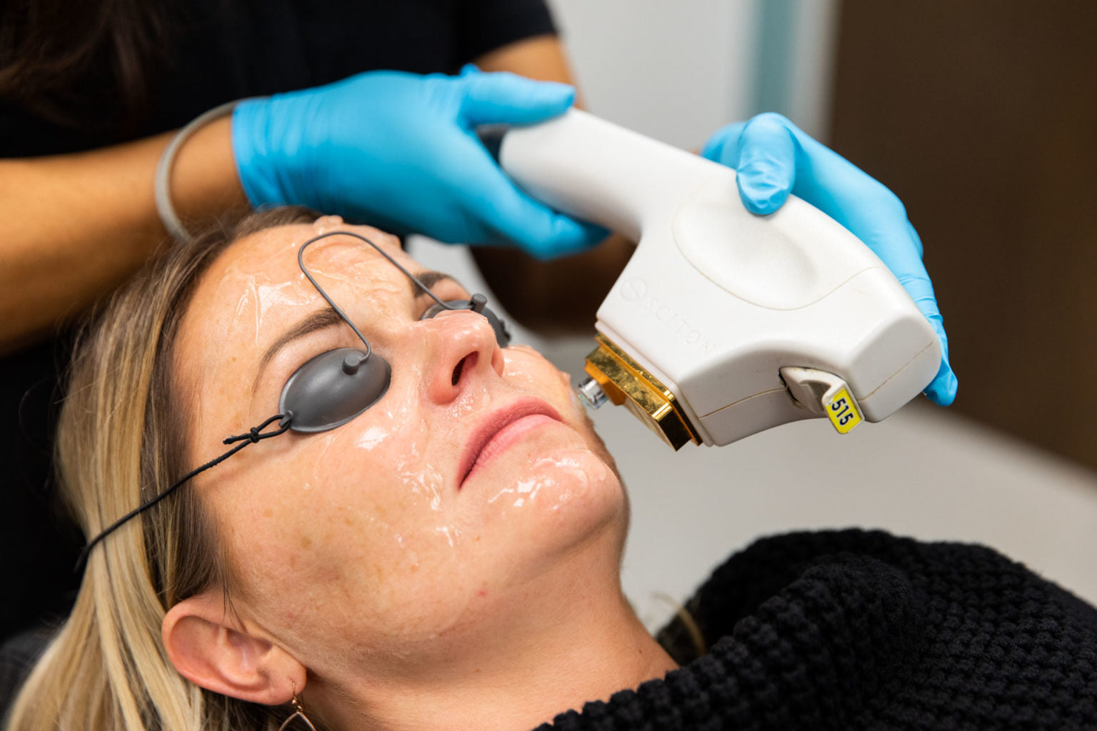 BBL HERO Photofacial Skin Rejuvenation for Face, Neck & Décolleté Course of 4 (save €500)