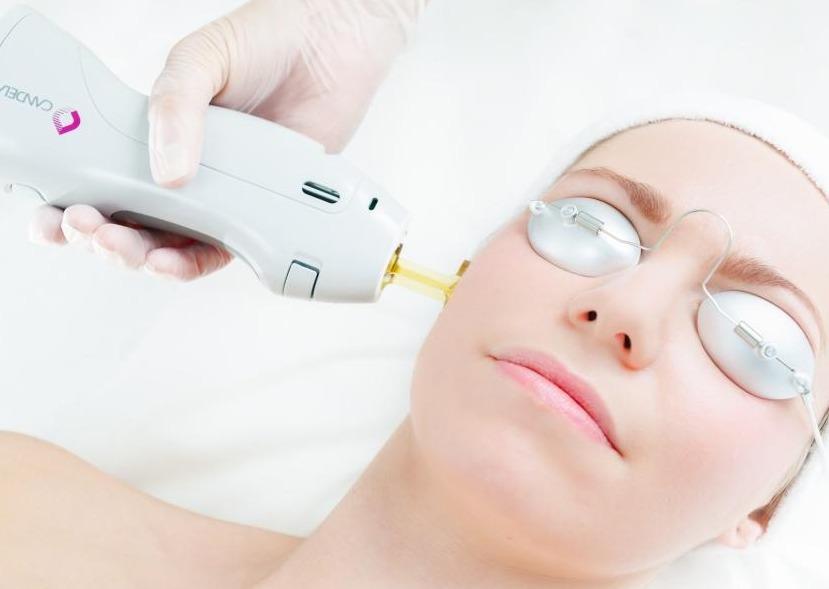 GMAX Laser skin rejuvenation for ageing, pigmentation or redness save up to €801