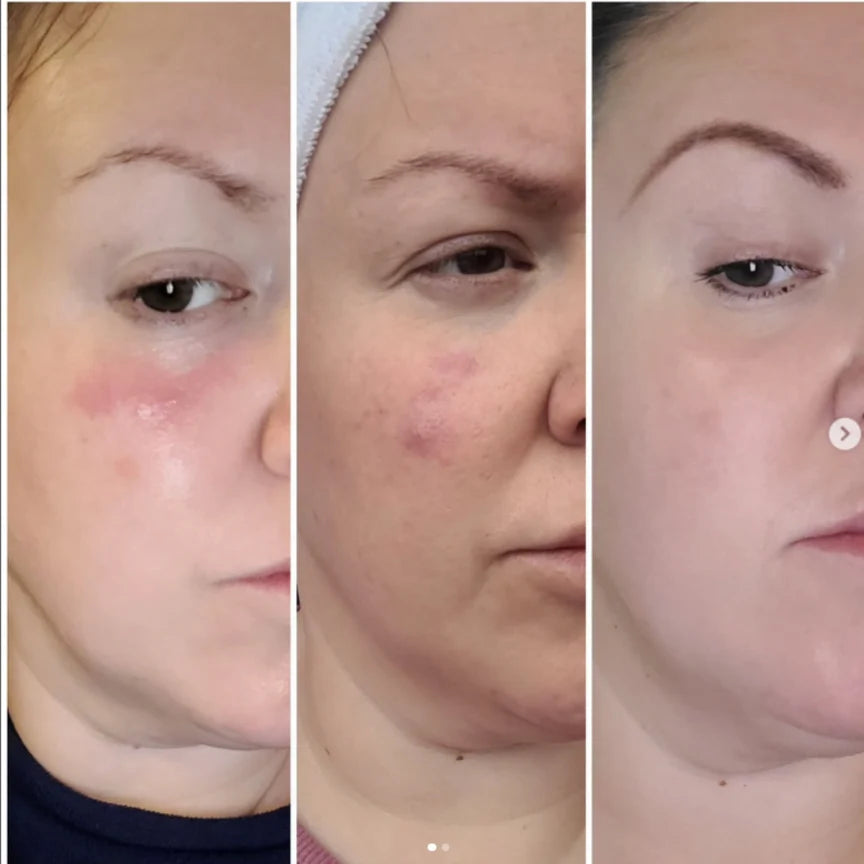 Sásta Microbiome Booster Serum 30ml