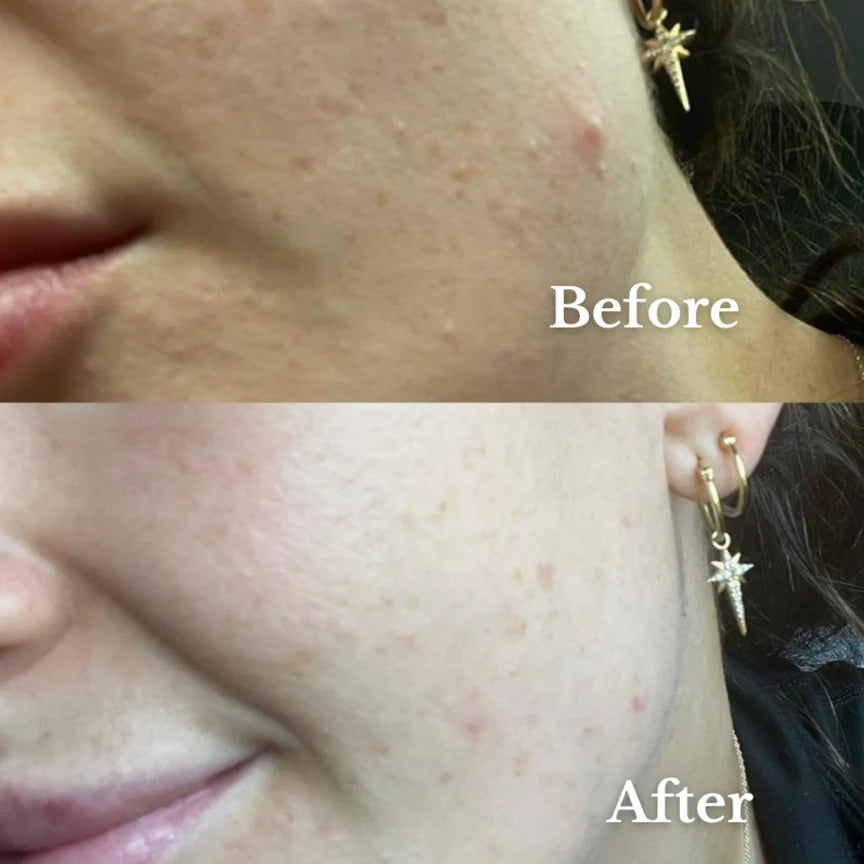Sásta Microbiome Booster Serum 30ml