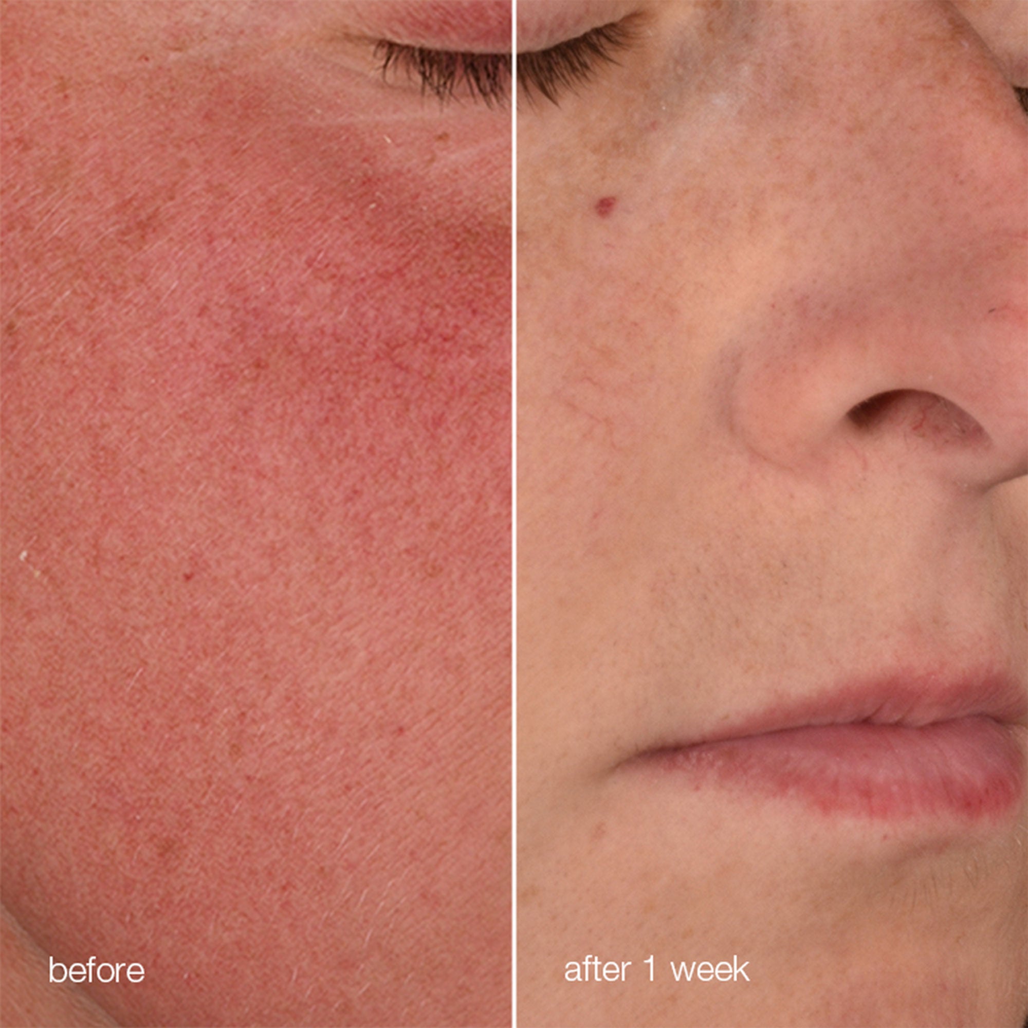 Dermalogica stabilizing repair cream + ultracalming cleanser