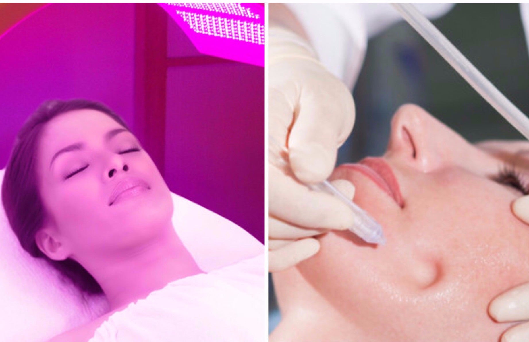 JetPeel & LED Phototherapy 60-Mins