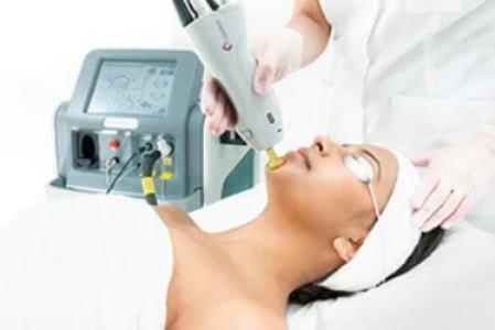 Laser skin rejuvenation consultation