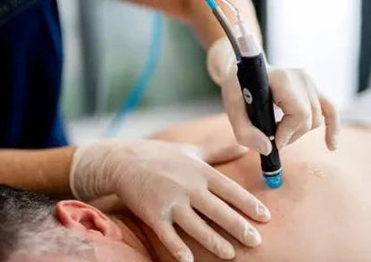 HydraFacial Back Acne Treatment Course of 3 with LED Light Therapy (save €241)