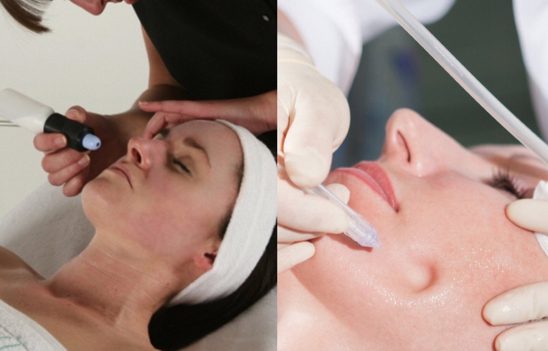 Ultimate 3-Step Facial: Microdermabrasion, JetPeel & LED Light Therapy