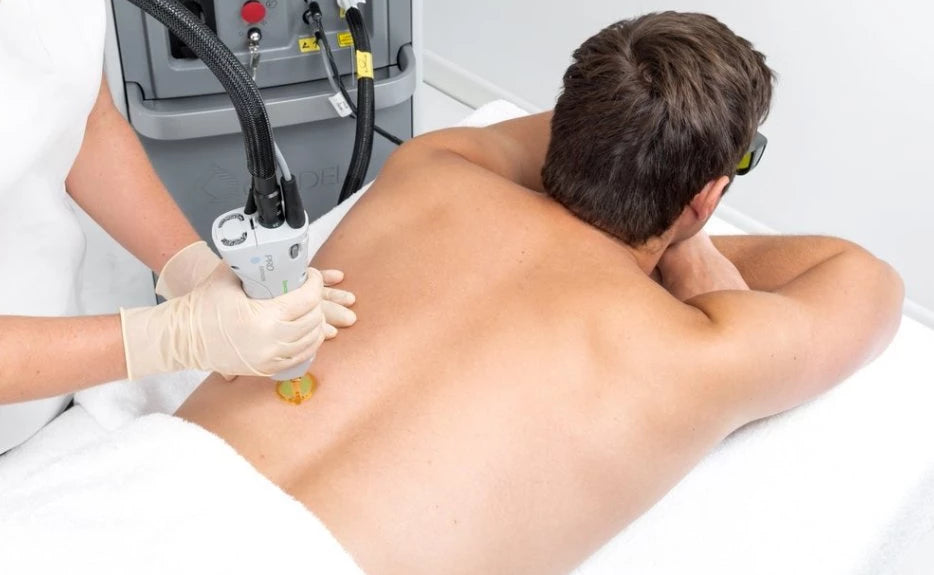 Laser for Men: Full Back or Chest & Stomach course of 6 (save €101)